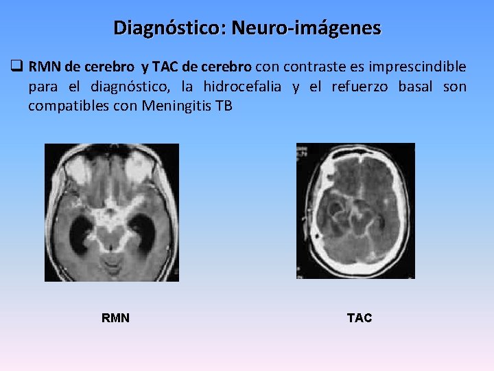 Diagnóstico: Neuro-imágenes q RMN de cerebro y TAC de cerebro contraste es imprescindible para