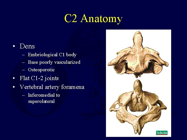C 2 Anatomy • Dens – Embriological C 1 body – Base poorly vascularized