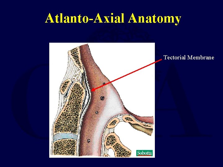 Atlanto-Axial Anatomy Tectorial Membrane 