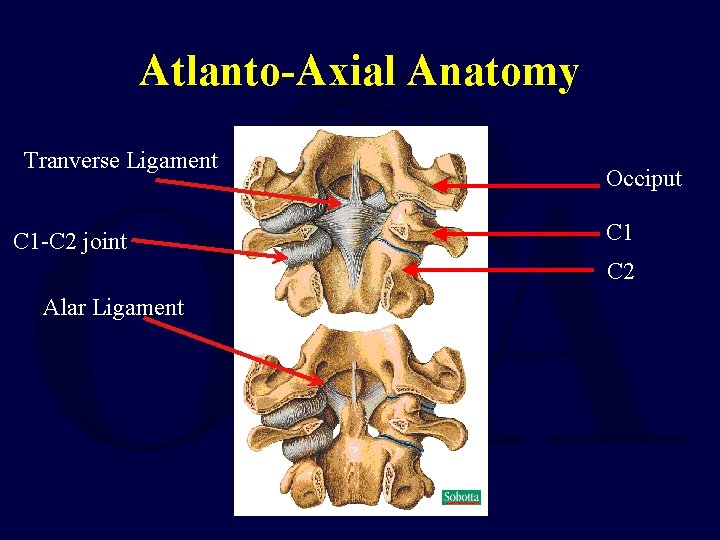 Atlanto-Axial Anatomy Tranverse Ligament C 1 -C 2 joint Occiput C 1 C 2