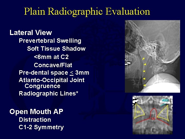 Plain Radiographic Evaluation Lateral View Prevertebral Swelling Soft Tissue Shadow <6 mm at C