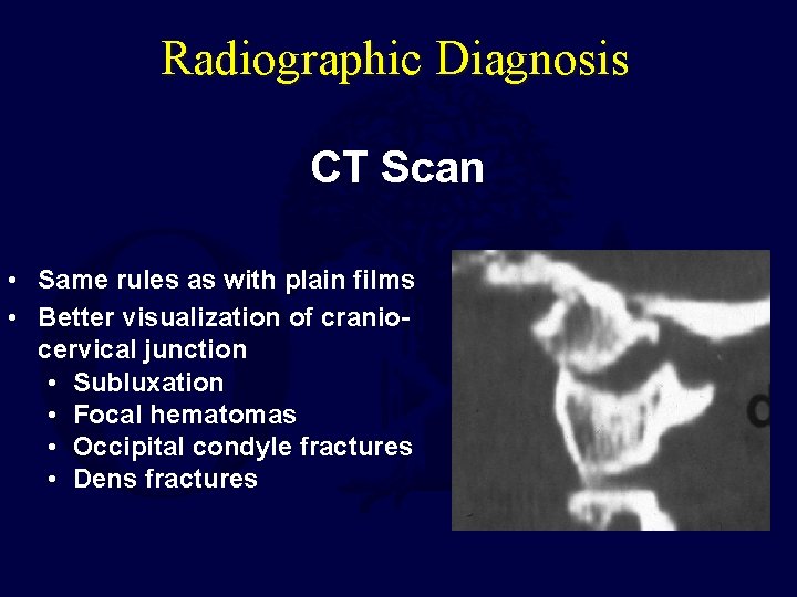 Radiographic Diagnosis CT Scan • Same rules as with plain films • Better visualization