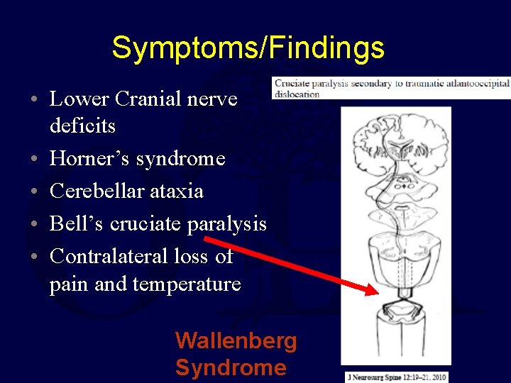 Symptoms/Findings • Lower Cranial nerve deficits • Horner’s syndrome • Cerebellar ataxia • Bell’s