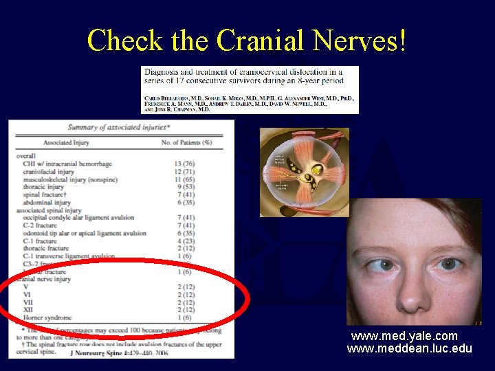 Check the Cranial Nerves! www. med. yale. com www. meddean. luc. edu 