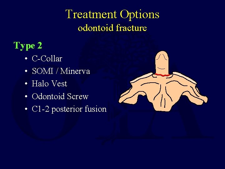Treatment Options odontoid fracture Type 2 • • • C-Collar SOMI / Minerva Halo