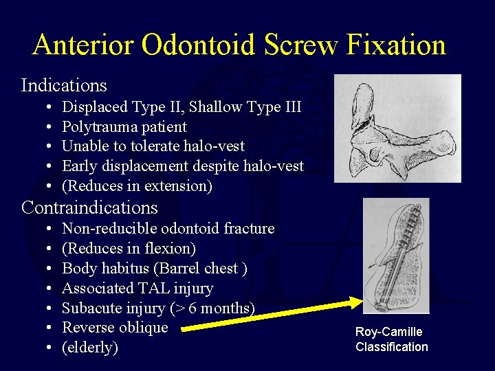 Anterior Odontoid Screw Fixation Indications • • • Displaced Type II, Shallow Type III