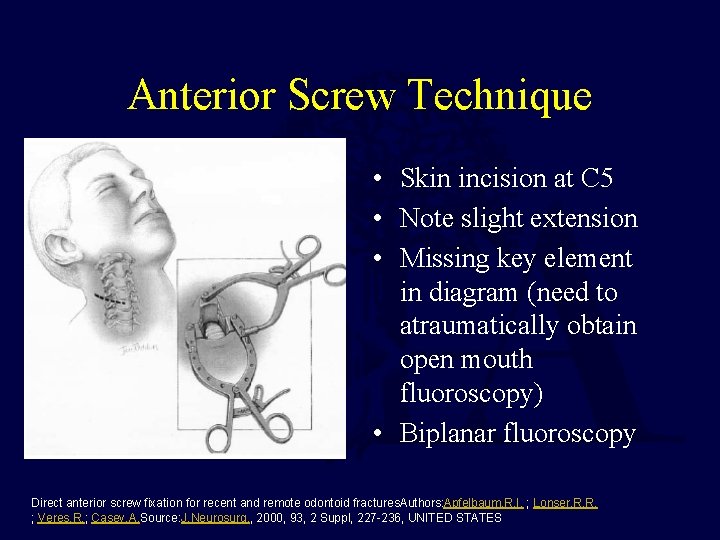 Anterior Screw Technique • Skin incision at C 5 • Note slight extension •