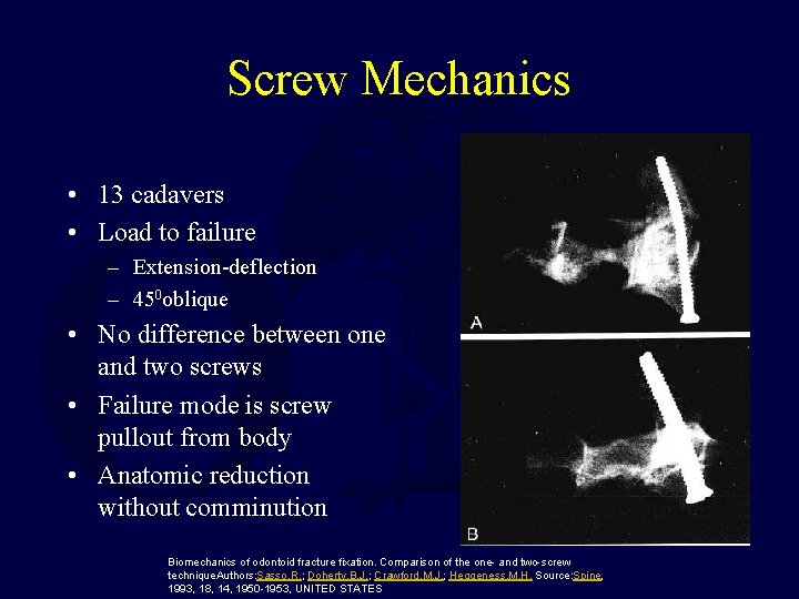 Screw Mechanics • 13 cadavers • Load to failure – Extension-deflection – 450 oblique