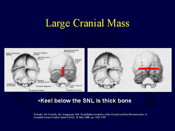 Large Cranial Mass • Keel below the SNL is thick bone Roberts, DA; Doherty,