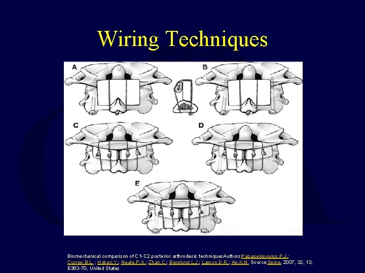 Wiring Techniques Biomechanical comparison of C 1 -C 2 posterior arthrodesis techniques. Authors: Papagelopoulos,