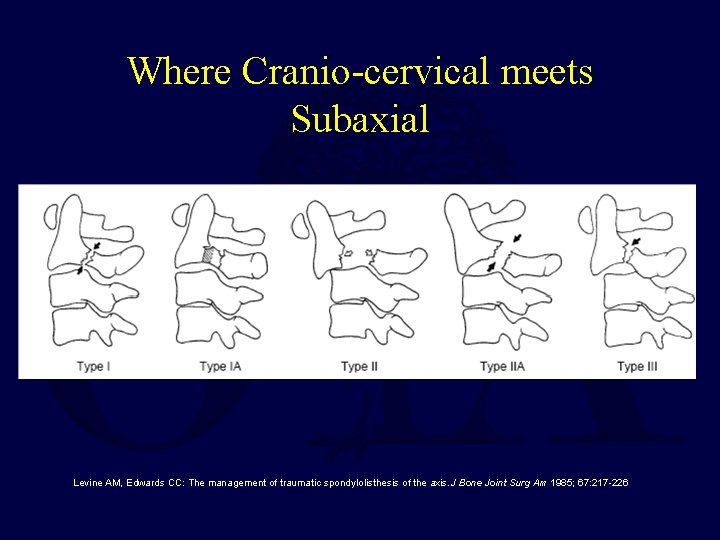 Where Cranio-cervical meets Subaxial Levine AM, Edwards CC: The management of traumatic spondylolisthesis of