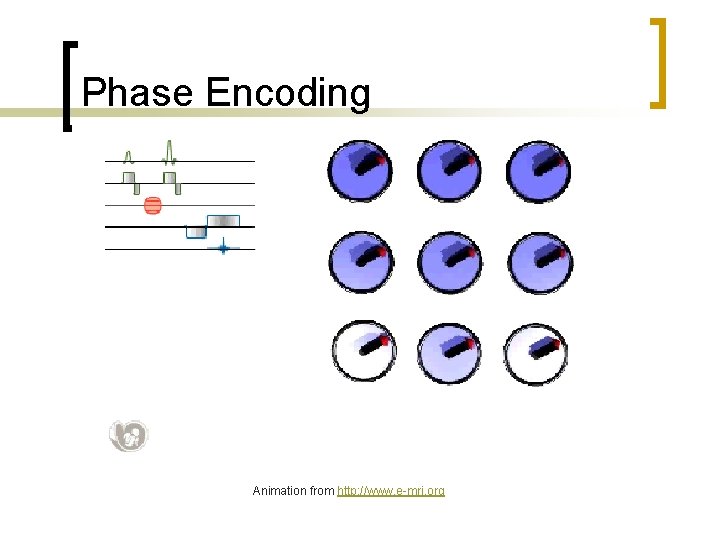 Phase Encoding Animation from http: //www. e-mri. org 