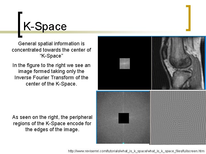 K-Space General spatial information is concentrated towards the center of “K-Space” In the figure