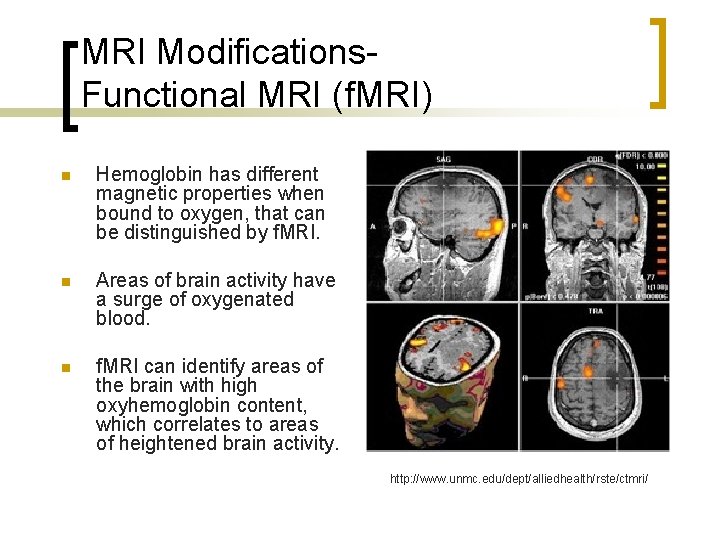 MRI Modifications. Functional MRI (f. MRI) n Hemoglobin has different magnetic properties when bound