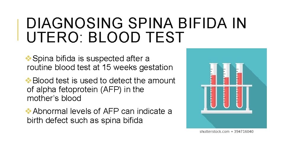 DIAGNOSING SPINA BIFIDA IN UTERO: BLOOD TEST v. Spina bifida is suspected after a