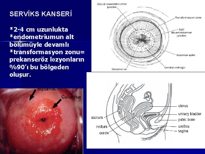 SERVİKS KANSERİ *2 -4 cm uzunlukta *endometriumun alt bölümüyle devamlı *transformasyon zonu= prekanseröz lezyonların