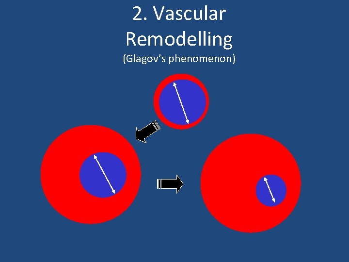 2. Vascular Remodelling (Glagov’s phenomenon) 