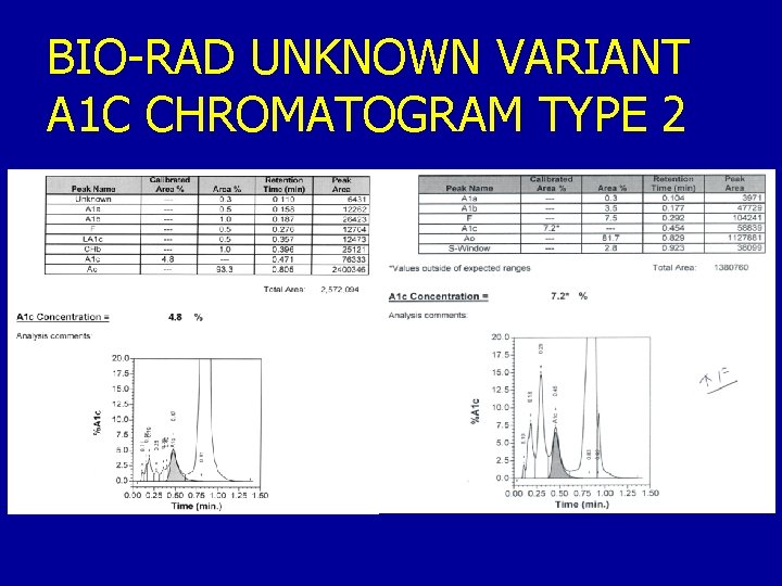BIO-RAD UNKNOWN VARIANT A 1 C CHROMATOGRAM TYPE 2 