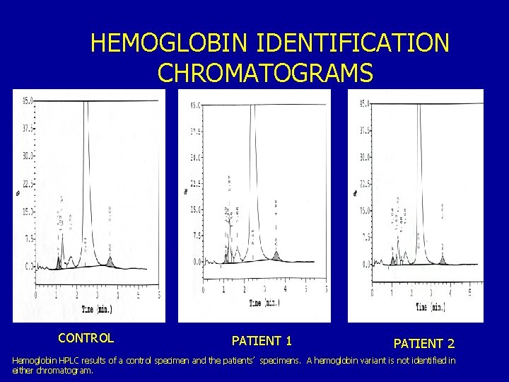 HEMOGLOBIN IDENTIFICATION CHROMATOGRAMS CONTROL PATIENT 1 PATIENT 2 Hemoglobin HPLC results of a control