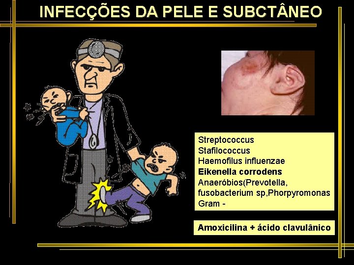 INFECÇÕES DA PELE E SUBCT NEO Streptococcus Stafilococcus Haemofilus influenzae Eikenella corrodens Anaeróbios(Prevotella, fusobacterium