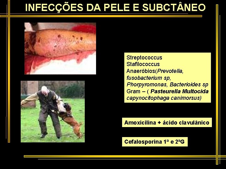 INFECÇÕES DA PELE E SUBCT NEO Streptococcus Stafilococcus Anaeróbios(Prevotella, fusobacterium sp, Phorpyromonas, Bacterioides sp