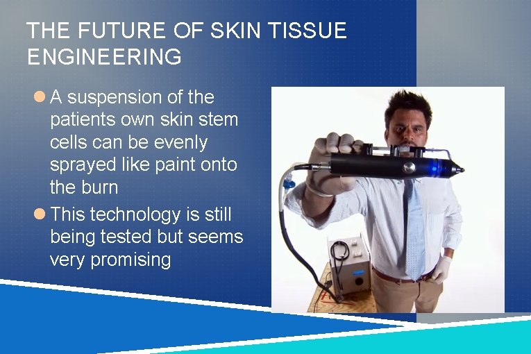 THE FUTURE OF SKIN TISSUE ENGINEERING A suspension of the patients own skin stem