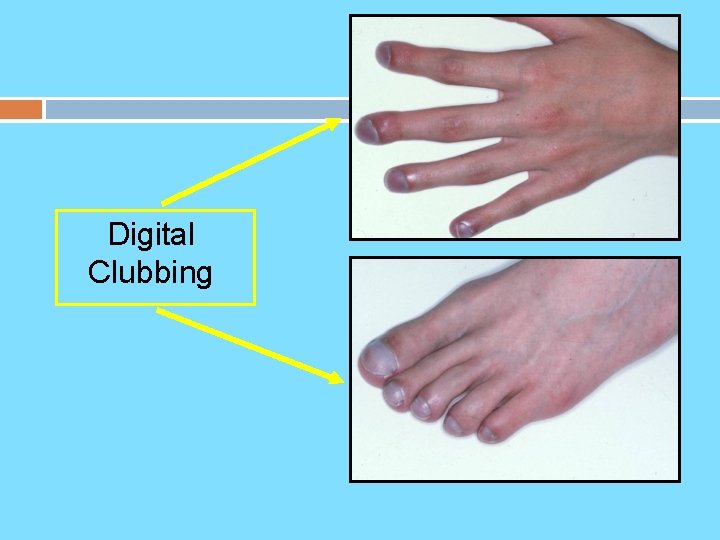 Digital Clubbing 