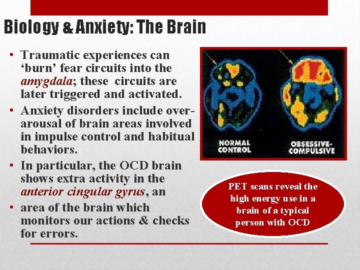Biology & Anxiety: The Brain • Traumatic experiences can ‘burn’ fear circuits into the