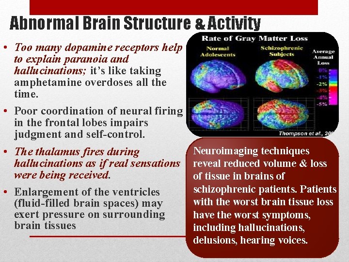 Abnormal Brain Structure & Activity • Too many dopamine receptors help to explain paranoia