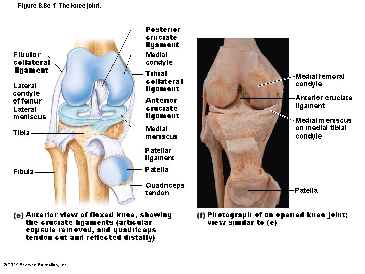 Figure 8. 8 e–f The knee joint. Fibular collateral ligament Lateral condyle of femur