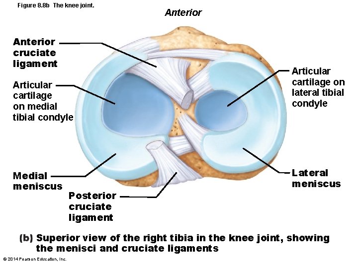 Figure 8. 8 b The knee joint. Anterior cruciate ligament Articular cartilage on medial