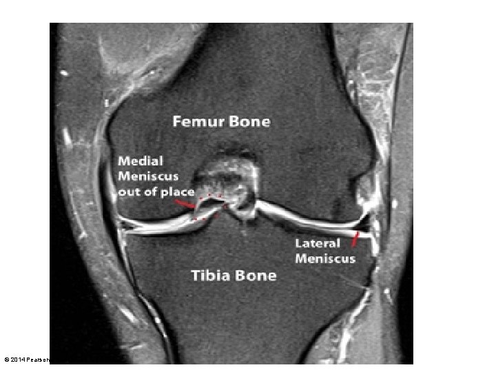 © 2014 Pearson Education, Inc. 