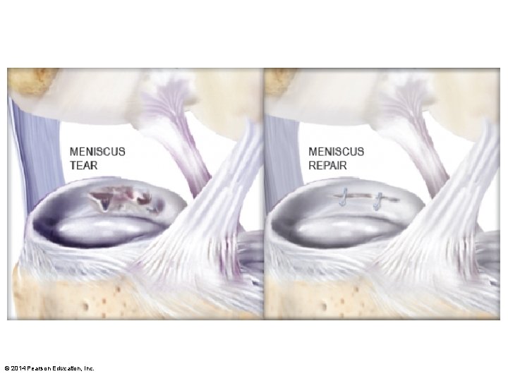 © 2014 Pearson Education, Inc. 