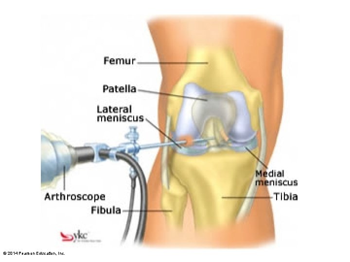 © 2014 Pearson Education, Inc. 