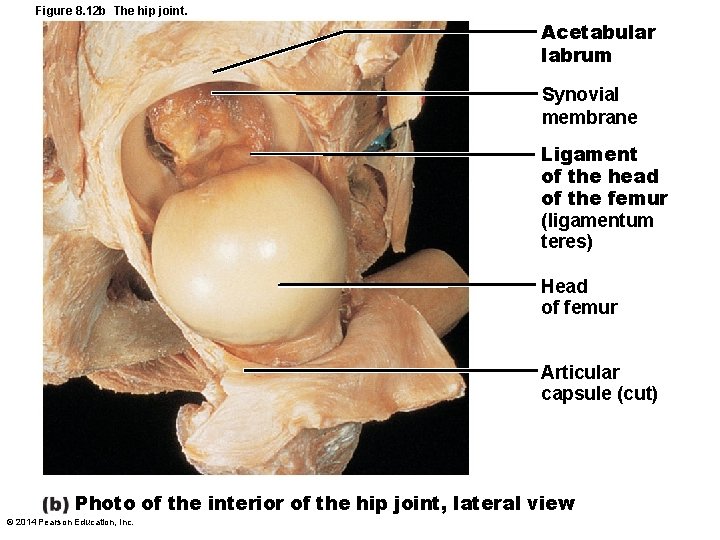 Figure 8. 12 b The hip joint. Acetabular labrum Synovial membrane Ligament of the