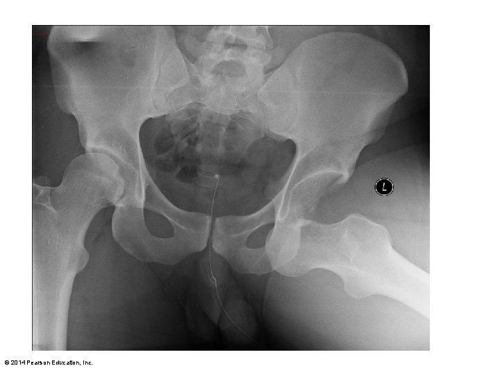 © 2014 Pearson Education, Inc. 