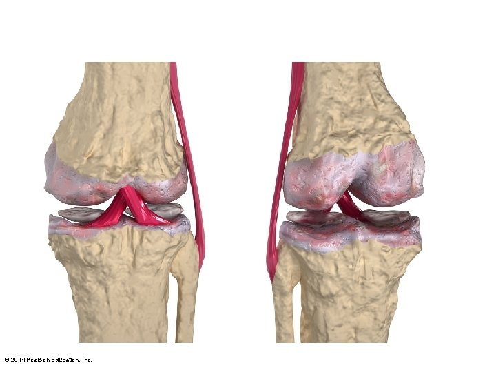 © 2014 Pearson Education, Inc. 