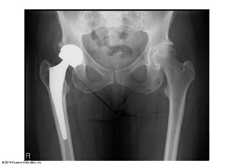 © 2014 Pearson Education, Inc. 