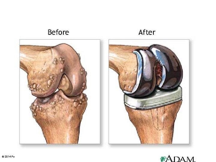 © 2014 Pearson Education, Inc. 