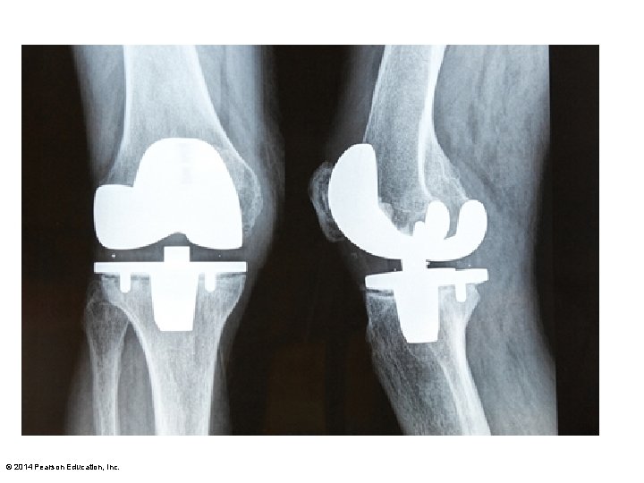 © 2014 Pearson Education, Inc. 