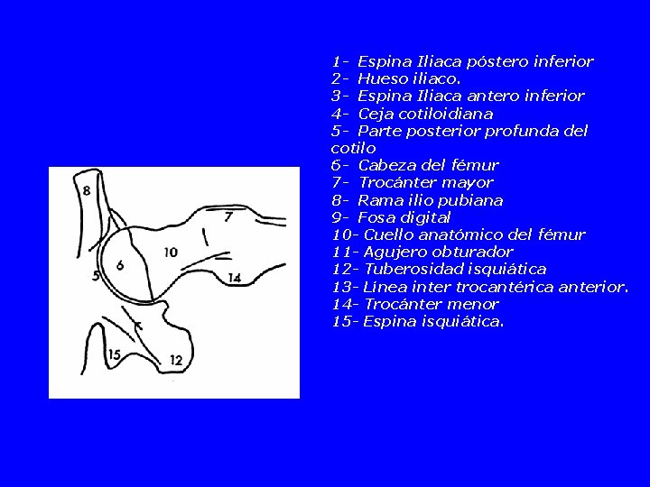 1 - Espina Iliaca póstero inferior 2 - Hueso iliaco. 3 - Espina Iliaca