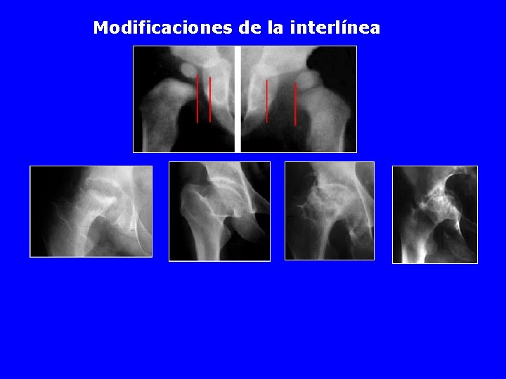 Modificaciones de la interlínea 