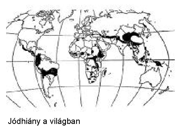 Jódhiány a világban 