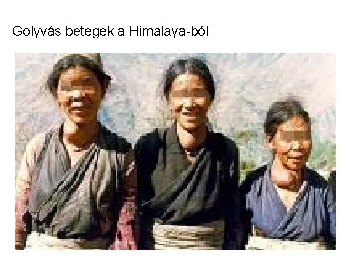 Golyvás betegek a Himalaya-ból 