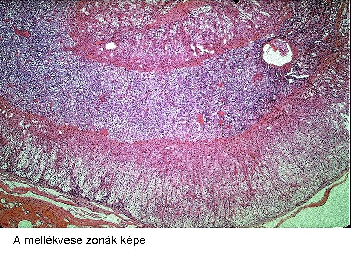 A mellékvese zonák képe 