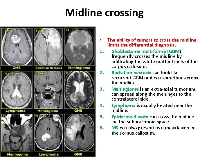 Midline crossing • 1. 2. 3. 4. 5. 6. The ability of tumors to