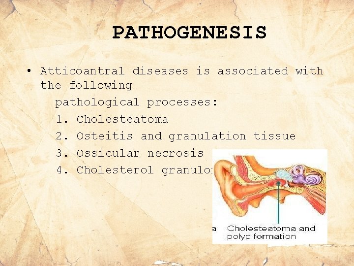 PATHOGENESIS • Atticoantral diseases is associated with the following pathological processes: 1. Cholesteatoma 2.