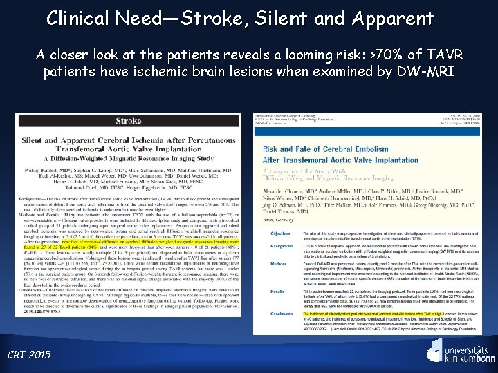 Clinical Need—Stroke, Silent and Apparent A closer look at the patients reveals a looming