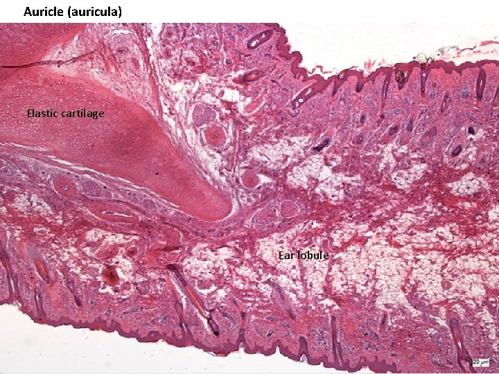 Auricle (auricula) Elastic cartilage Ear lobule 