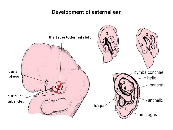 Development of external ear the 1 st ectodermal cleft basis of eye auricular tubercles